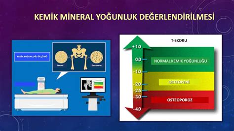 Spor ve Kemik Yoğunluğu: Aktivitenin Kemikleri Güçlendirme ve Osteoporoz Riskini Azaltma Potansiyeli